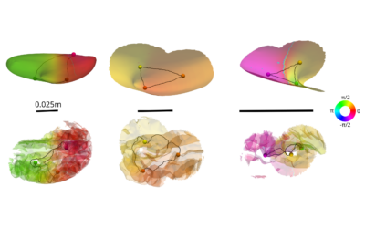 New paper by David M Alexander and Laura Dugué : a novel method for estimating spatial spectra from irregularly sampled intracranial EEG data